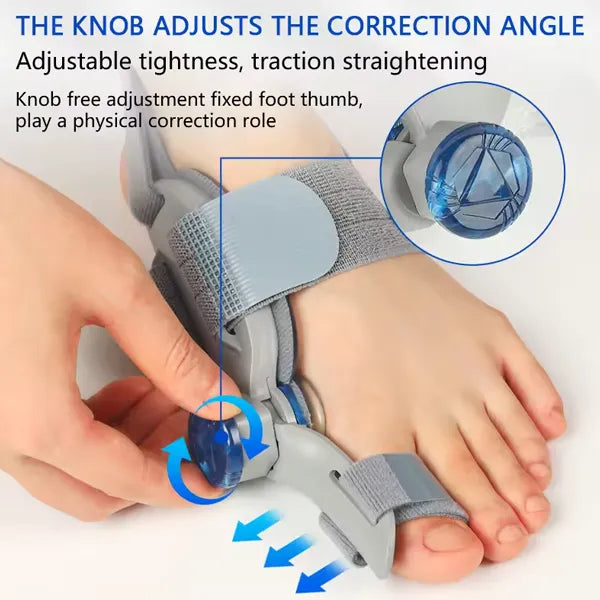 Finyra Bunion Correctors