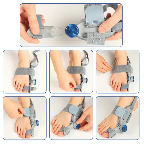 Finyra Bunion Correctors